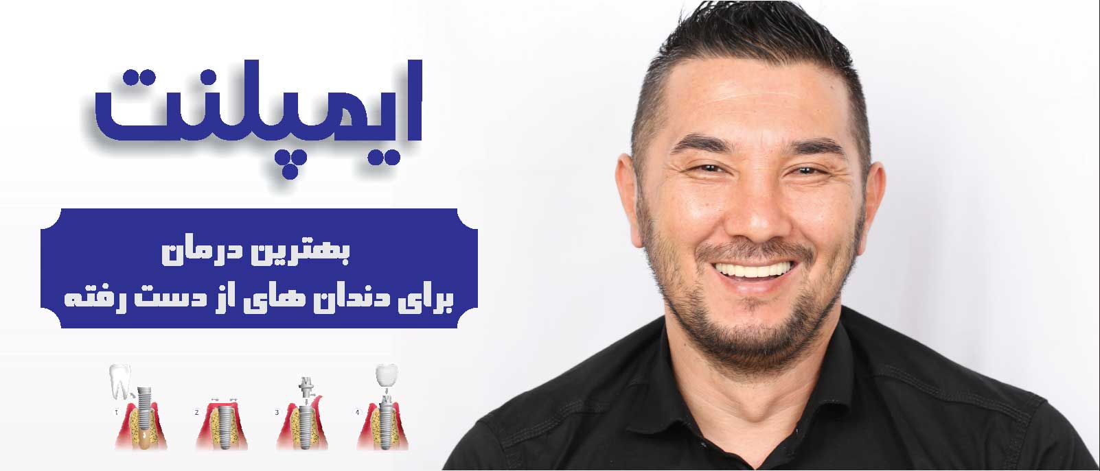 ایمپلنت دندان کلینیک تخصصی دندانپزشکی آرمانی ایمپلنت دندان کلینیک تخصصی دندانپزشکی آرمانی
