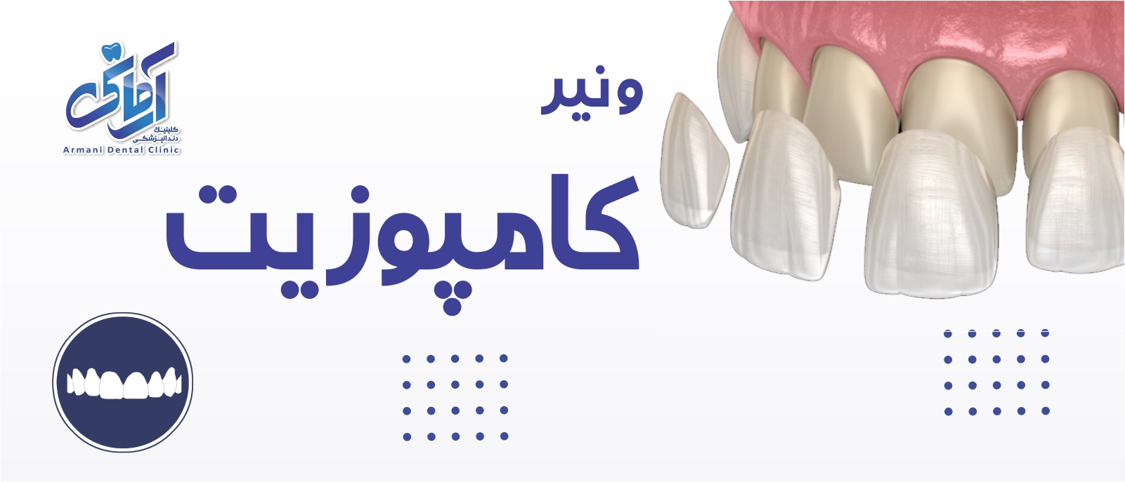 composite-banner بنر کامپوزیبت ونیز