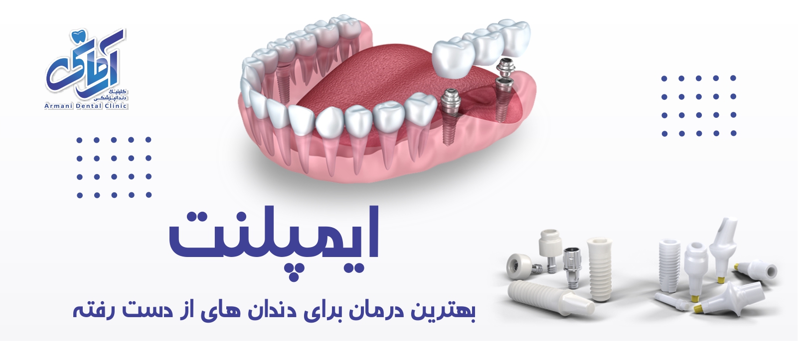 implant-banner ایمپلنت بهترین درمان دندان
