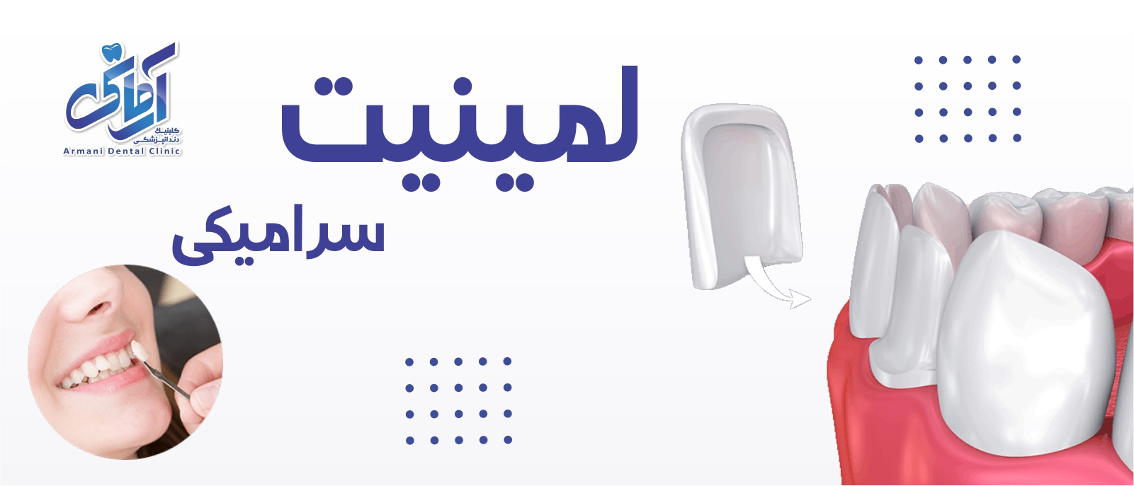 laminait-banner لمینت سرامیکی