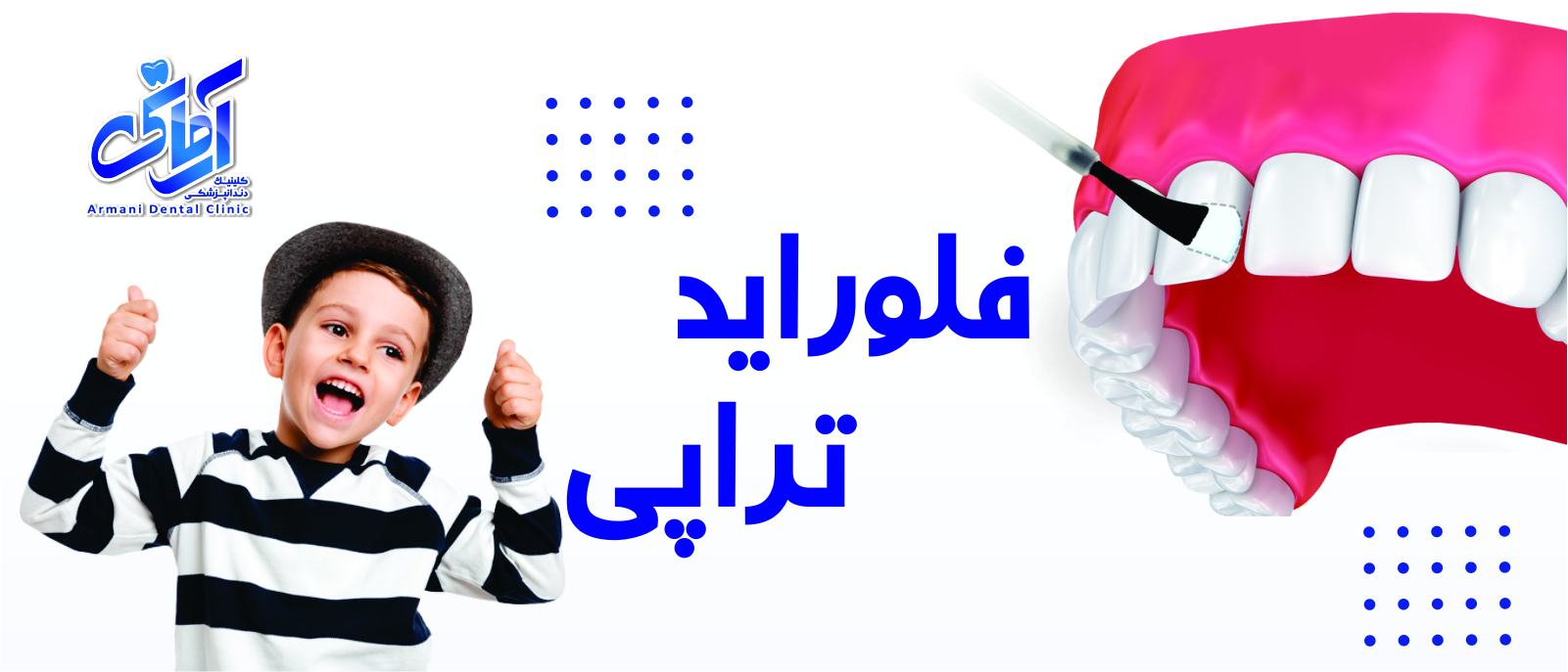 FLUORIDE-BANNER فلوراید تراپی
