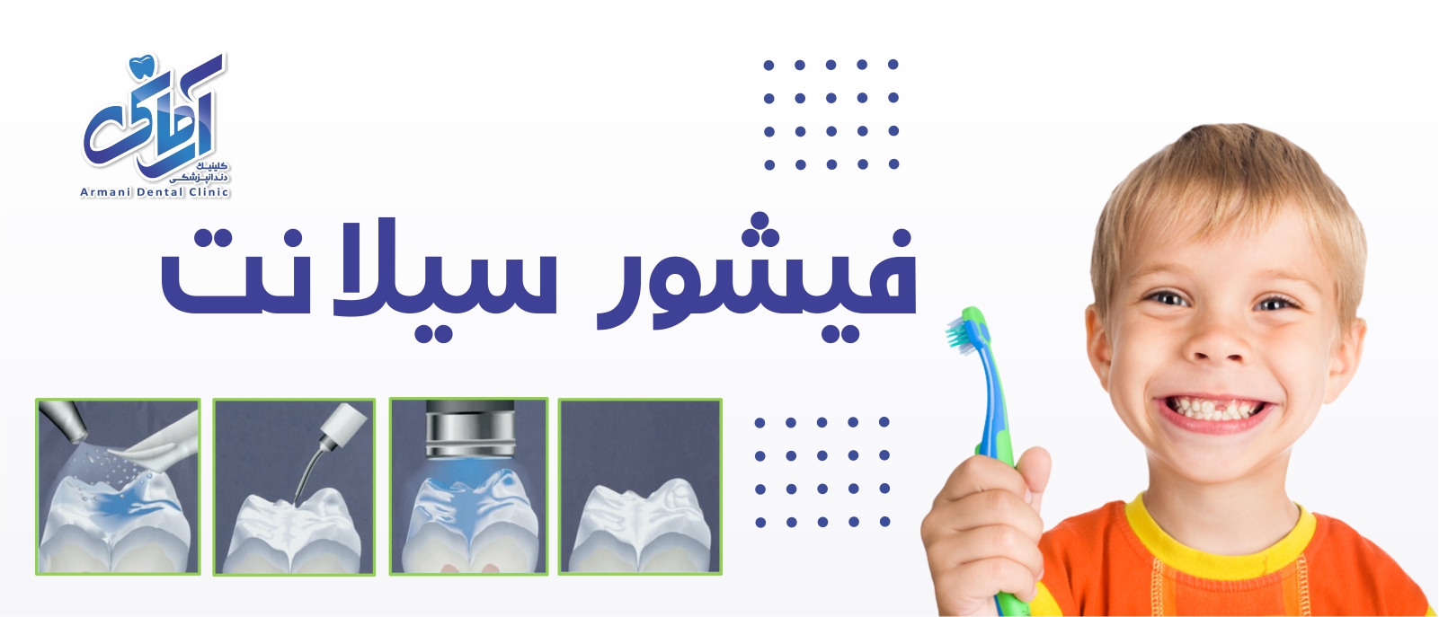 fissure-banner فیشتور سیلانت