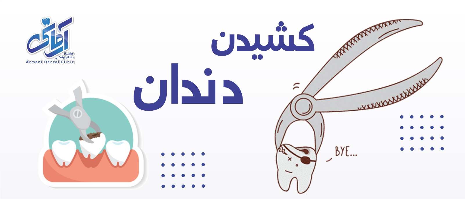 pull-banner کشیدن دندان