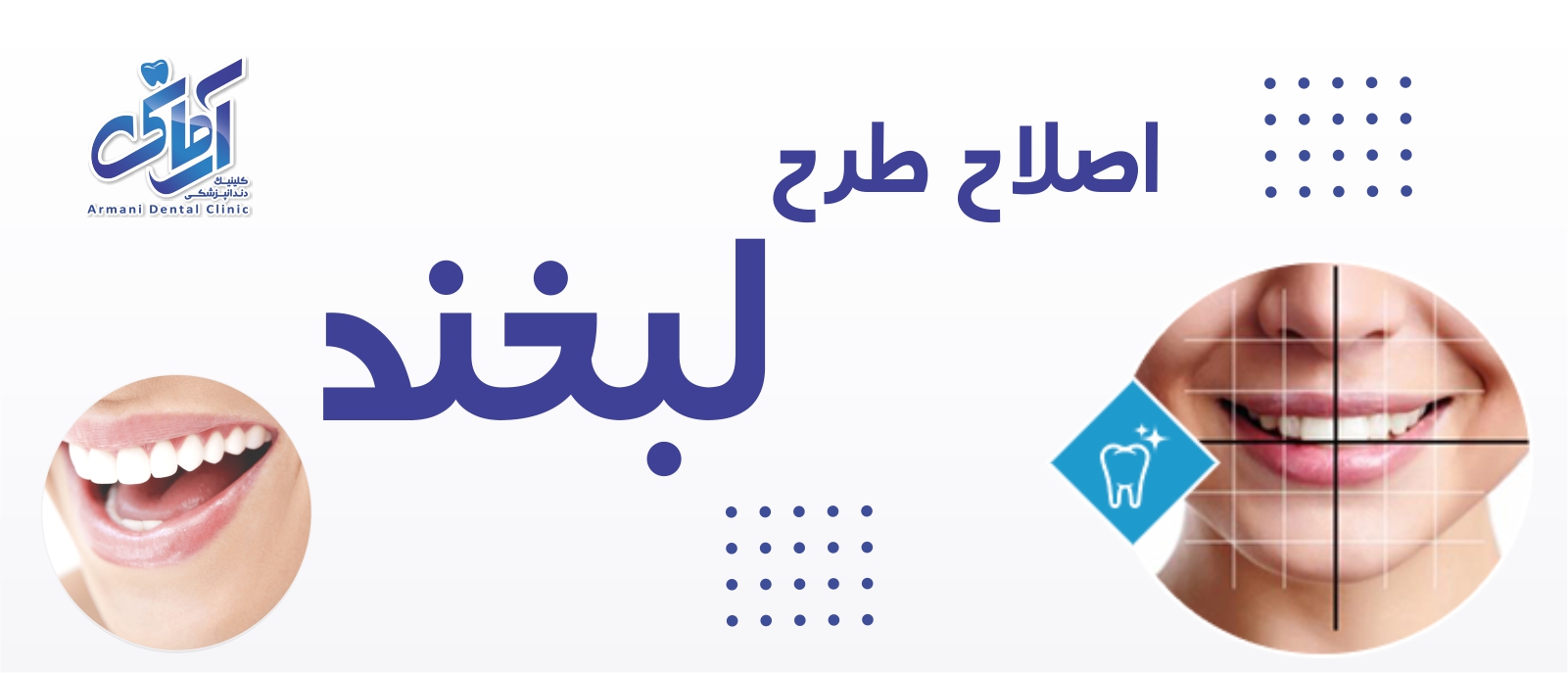 smile-design-banner اصلاح طرح لبخند