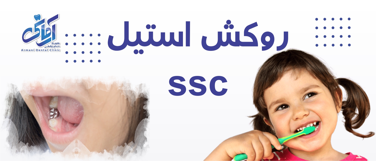 ssc-banner روکش استیل SSC