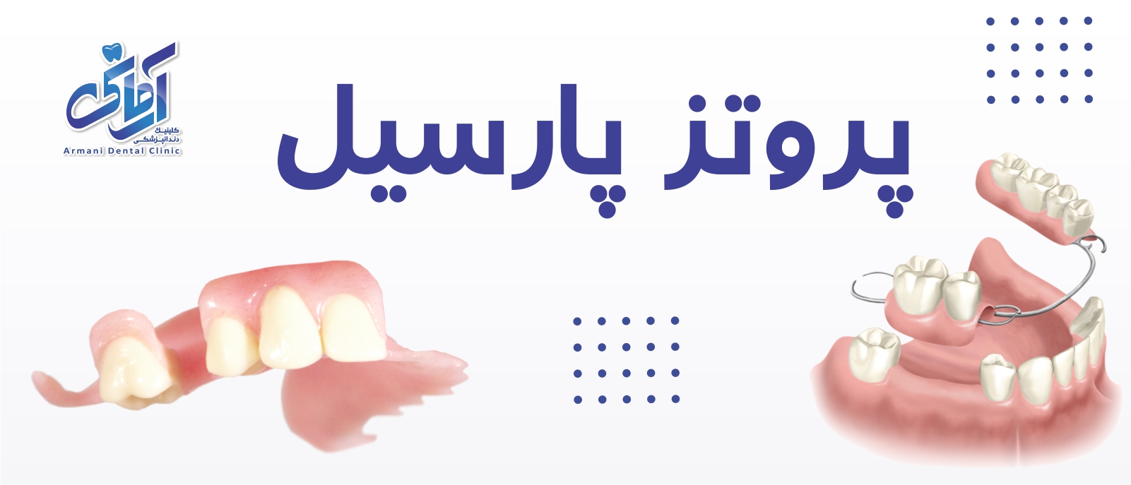 Partial-denture-banner پروتز پارسیل