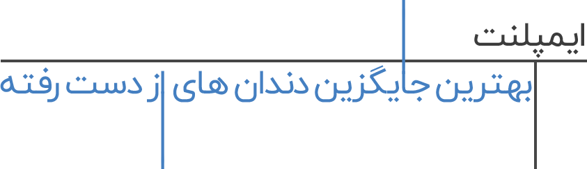 ایمپلنت شهریار