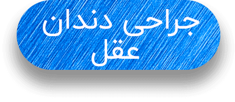 متن جراحی دندان عقل