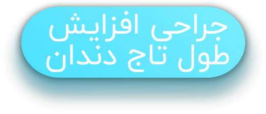 جراحی افزایش طول تاج دندان