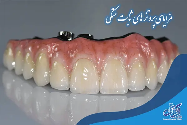 مزایای پروتز های ثابت متکی 