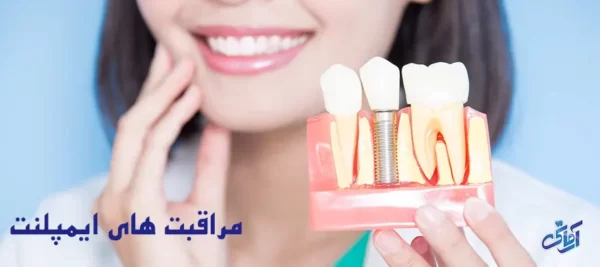 مراقبت های ایمپلنت