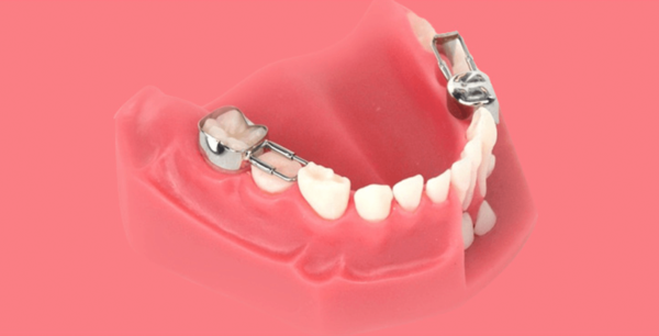 فضا نگهدار 1 فضا نگهدار ماکت دندان پزشکی آرمانی