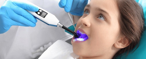 فیشور سیلانت 1 فیشور سیلانت