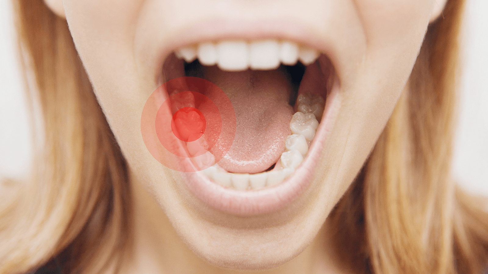 عامل خطرساز برای دندان