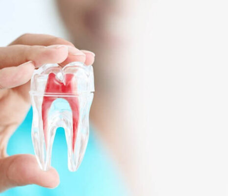 درمان ریشه و عصب کشی