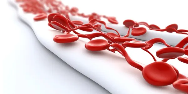 اختلالات انعقاد خون
