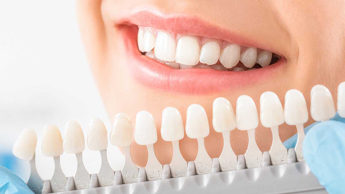 عدم زیاده روی در سفید کردن دندان