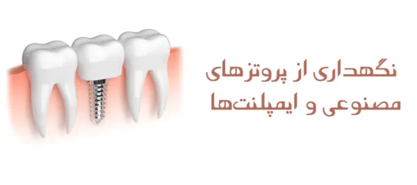 نگهداری از پروتزهای مصنوعی و ایمپلنت‌ها