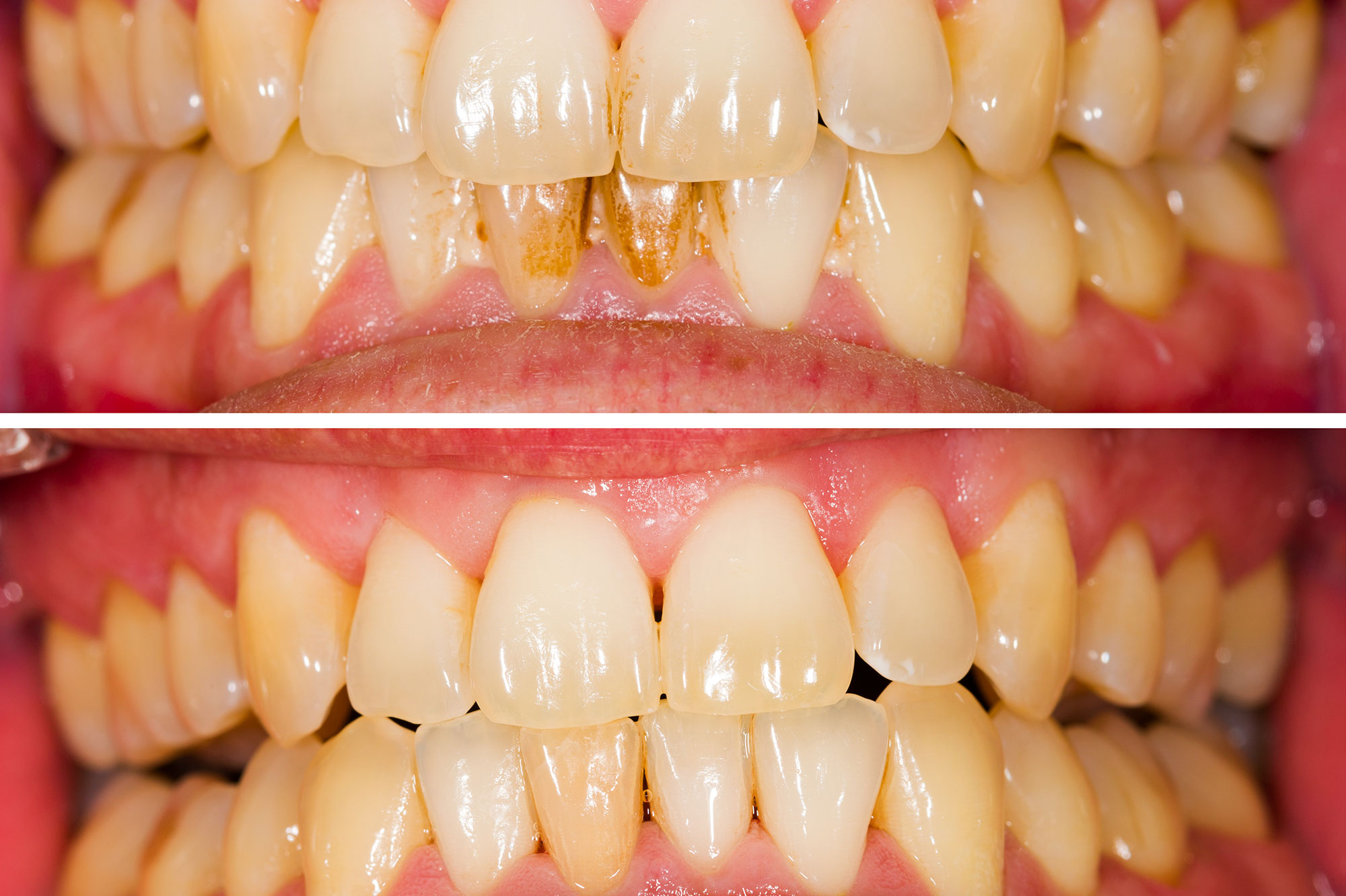 مشکلات ژنتیکی دندان