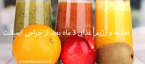 تغذیه و رژیم غذایی 3 ماه بعد از جراحی ایمپلنت