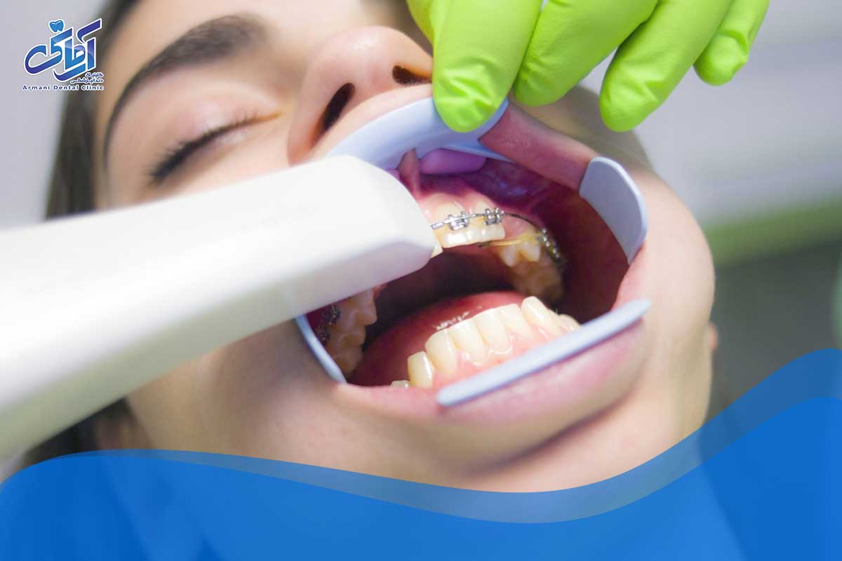 ترس از دندانپزشکی در ارتودنسی