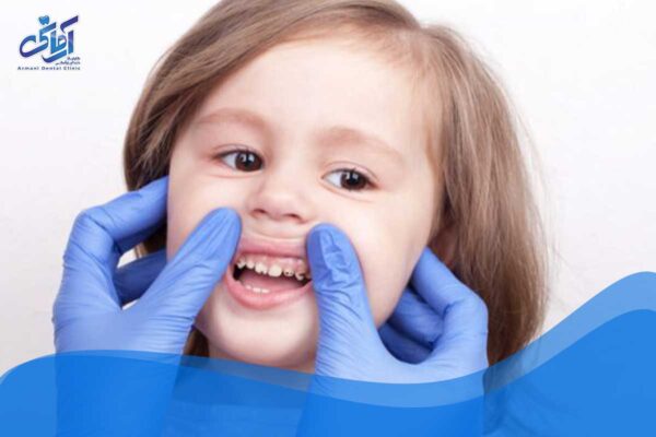 سلامت دهان و دندان در کودکان