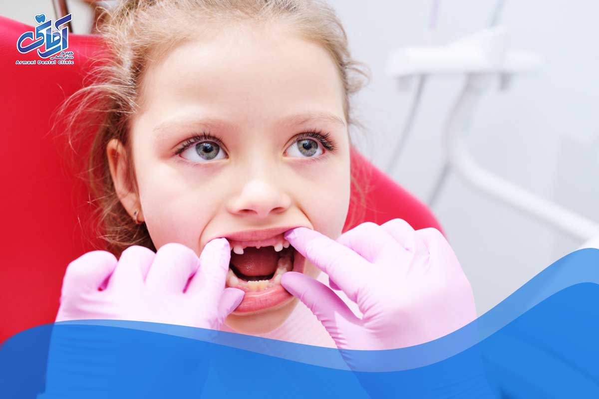 برای بهبود سلامت دهان و دندان در کودکان چه باید کرد؟