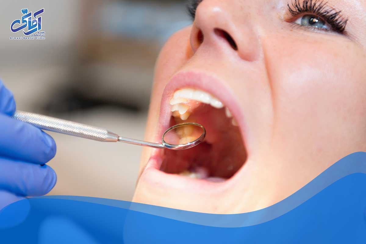 پیشگیری از خطر از دست دادن دندان