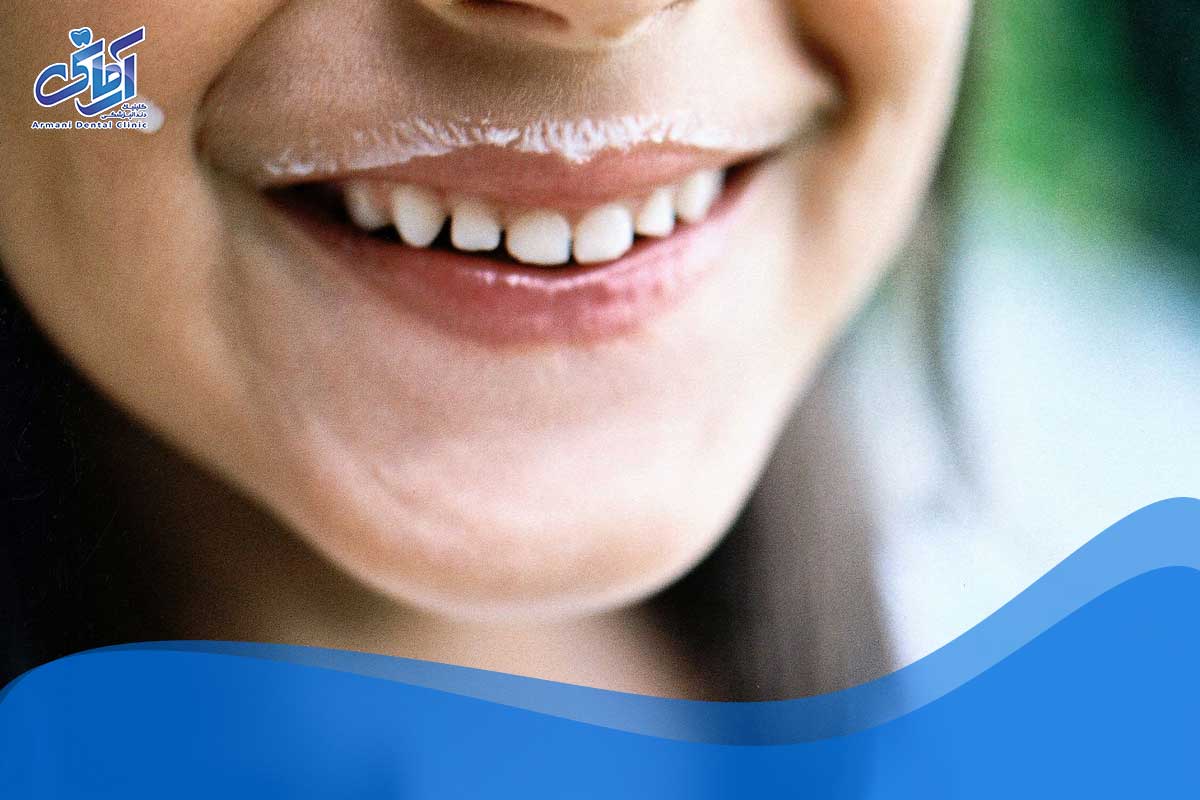 تفاوت بین دندان شیری و دندان دائمی