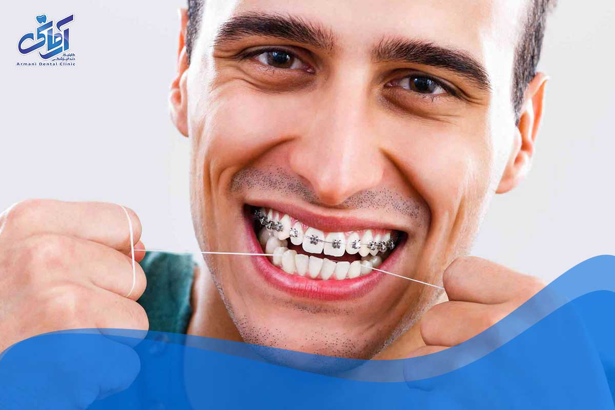 عوامل موثر بر ثبات دندان
