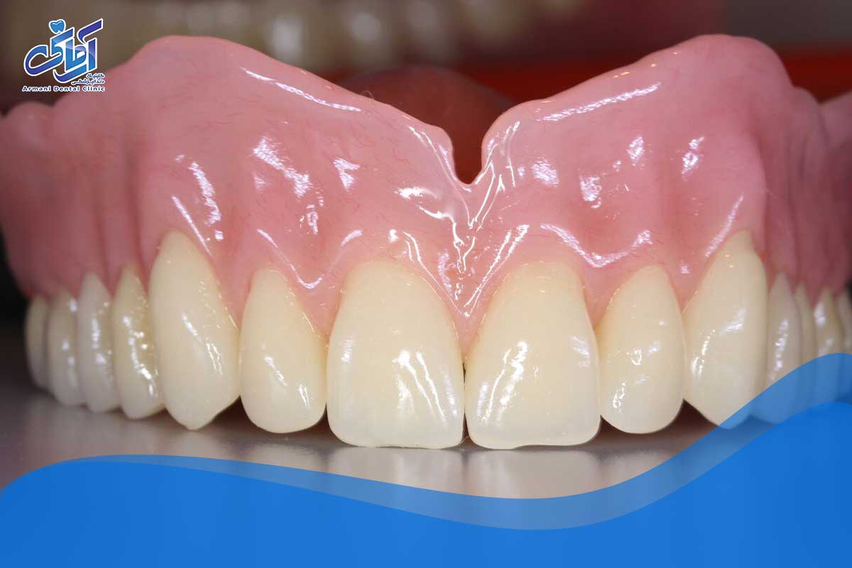 آیا دندان مصنوعی باعث ایجاد لکه های دردناک یا عفونت می شود؟
