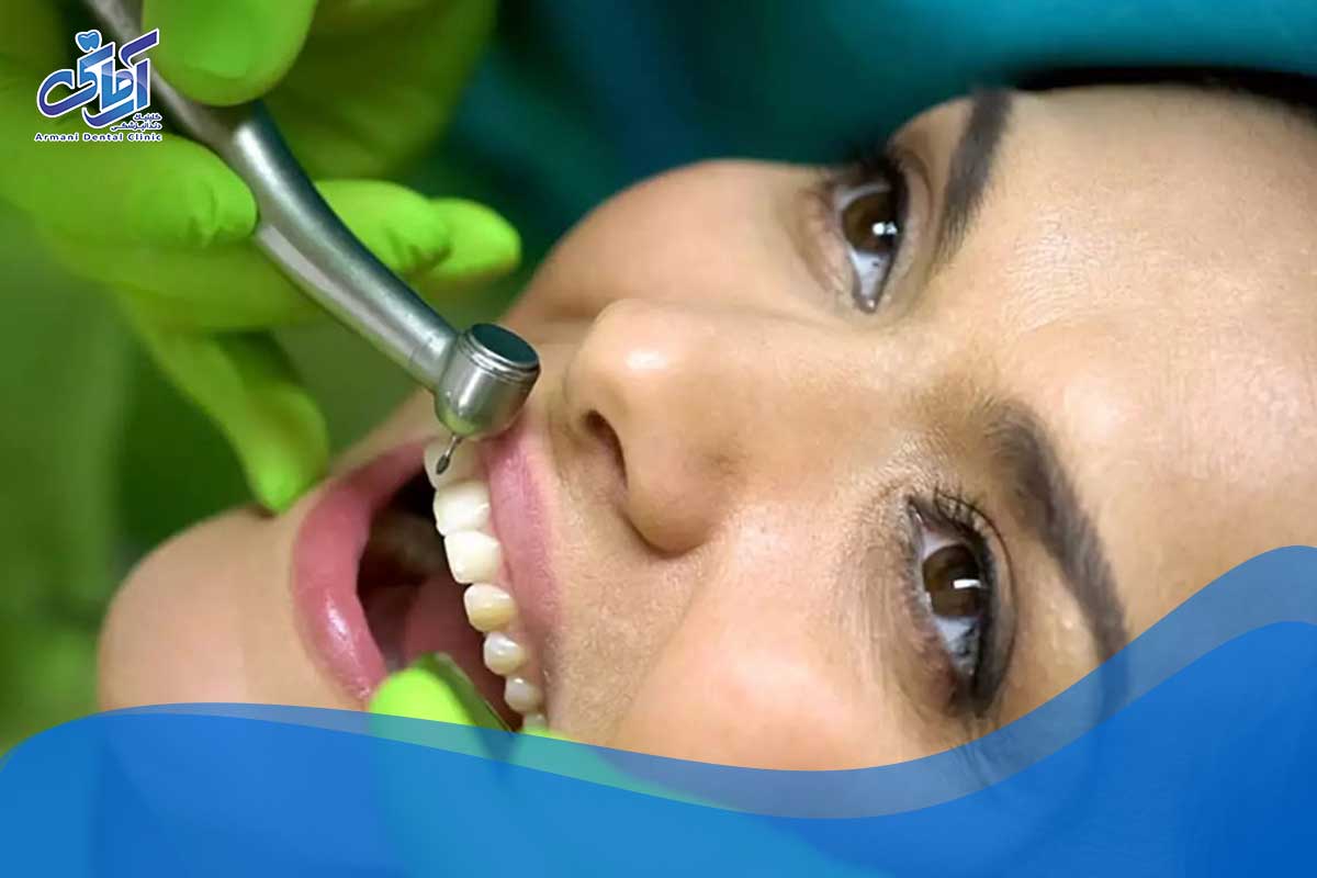 تکنیک های مختلف مورد استفاده در توانبخشی کامل دهان