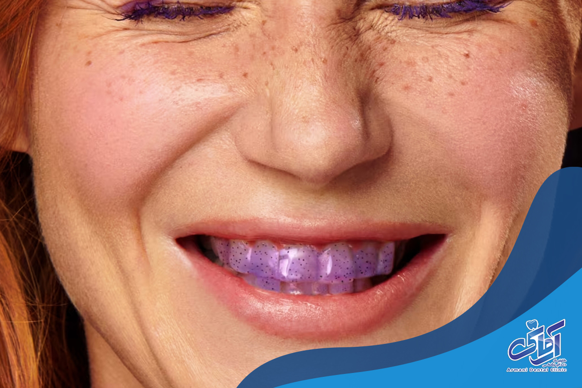خمیر دندان بنفش چیست؟