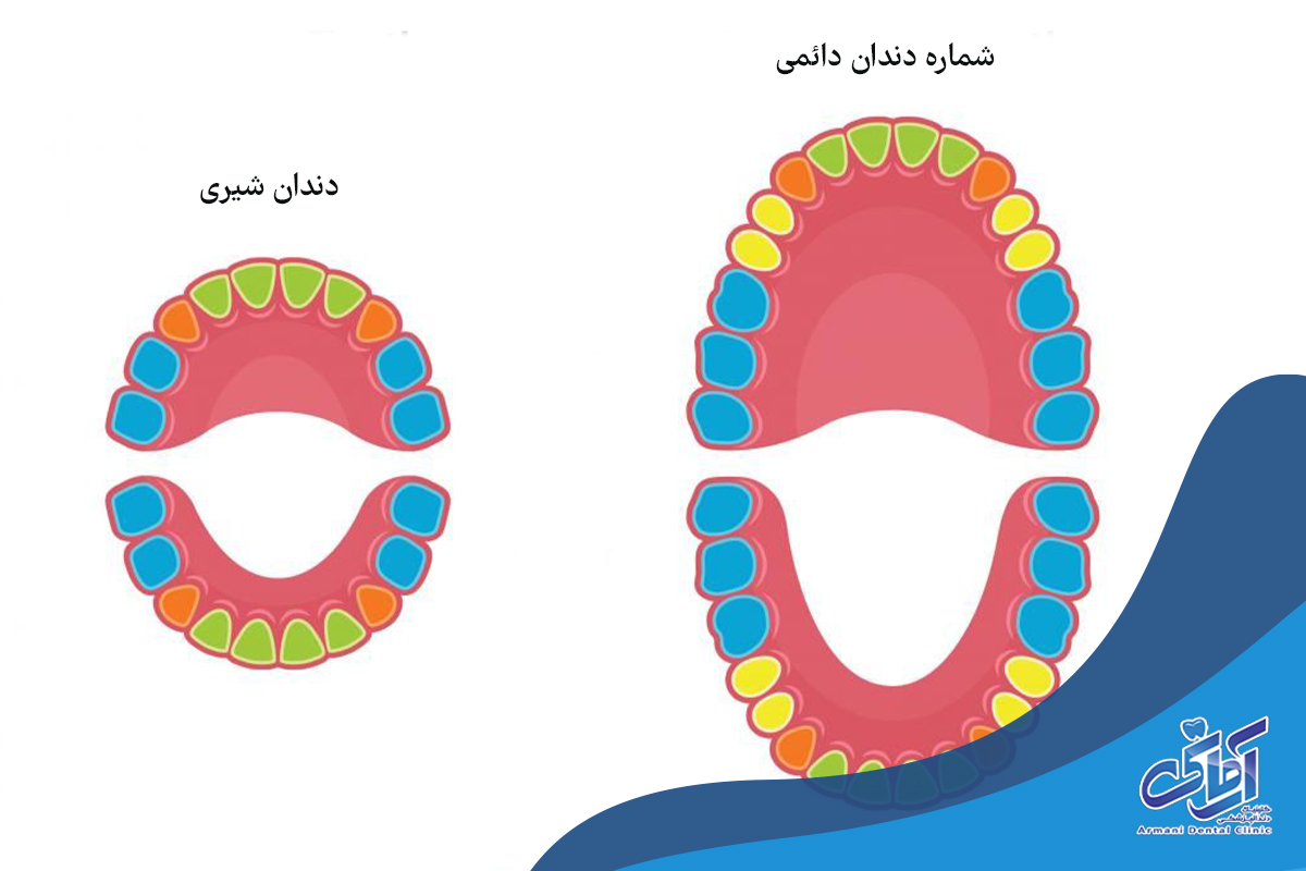 رایج ترین سیستم شماره گذاری دندان چیست؟