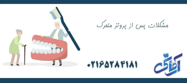 مشکلات پس از پروتز متحرک