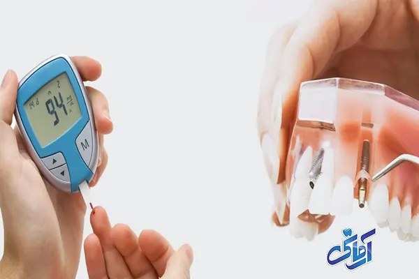 آیا افراد دیابتی می توانند ایمپلنت کنند