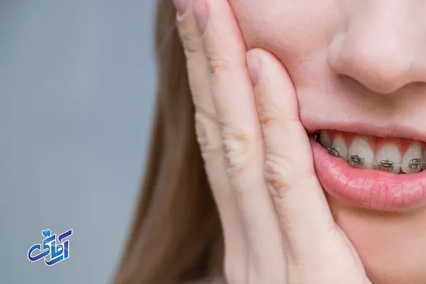 عوارض ارتودنسی دندان