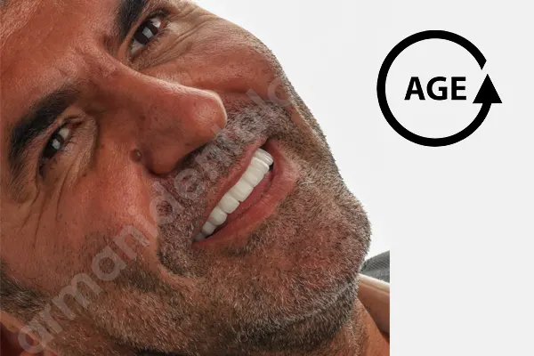 محدوده سنی ایمپلنت دندان