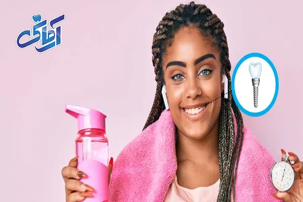 ورزش بعد از ایمپلنت