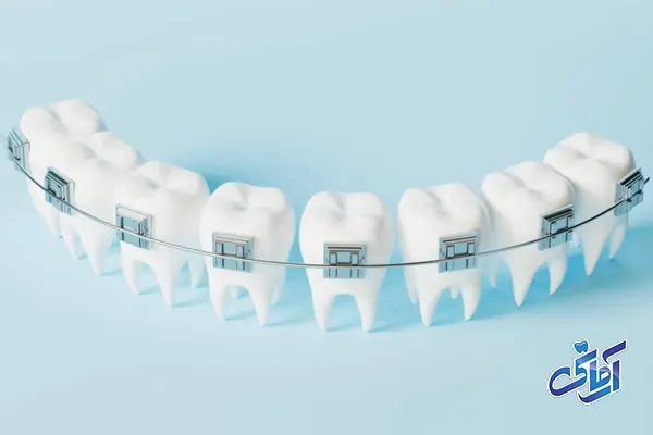 ارتودنسی در شهریار، ارتودنسی بزرگسالان و کودکان !! 1 ارتودنسی