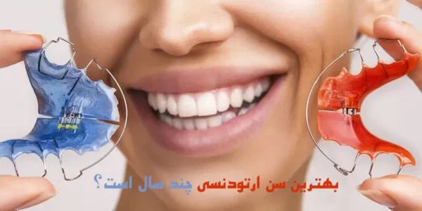 بهترین سن ارتودنسی چند سال است؟ 