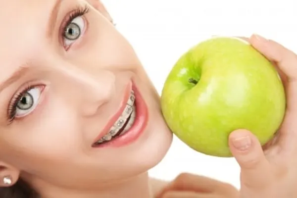 مراقبت های بعد از برداشت براکتهای ارتودنسی دندان 1 مراقبت های بعد ارتودنسی دندان