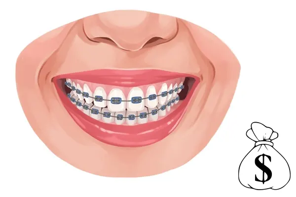 هزینه ارتودنسی دندان در شهریار