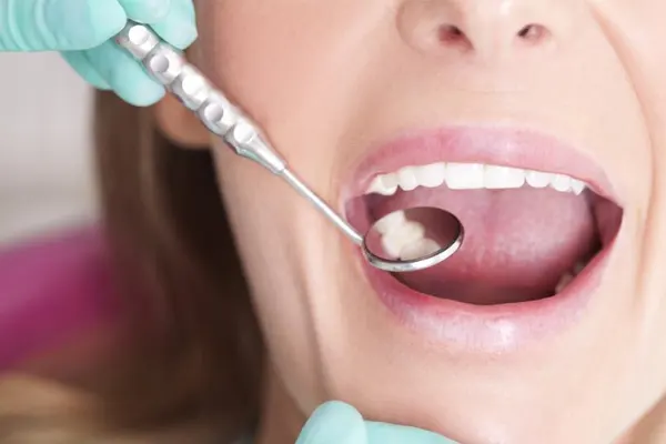 مراقبت های قبل ارتودنسی دندان