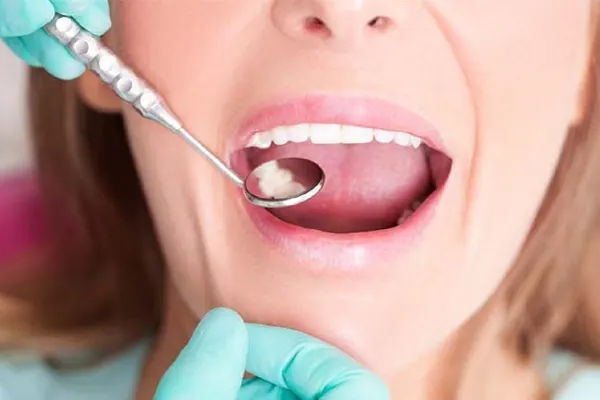 آیا ایمپلنت دندان باعث سرطان می شود؟