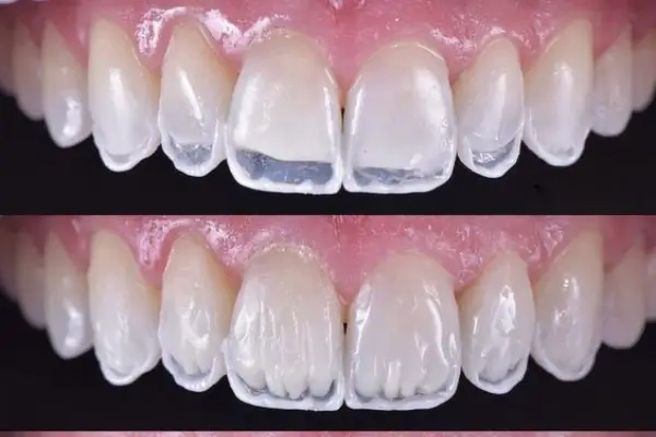 لبه شیشه‌ای