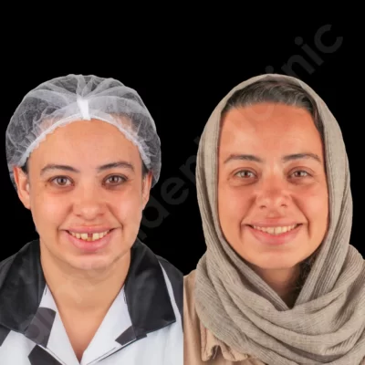 مراقبت های قبل ارتودنسی دندان و نکات مهمی که باید بدانید. 2 در کلینیک آرمانی 18