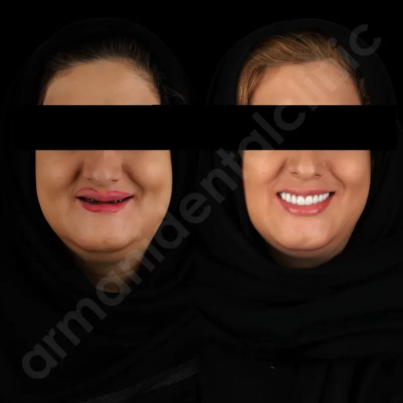 آرمانی 12