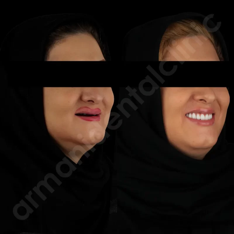 آرمانی 13