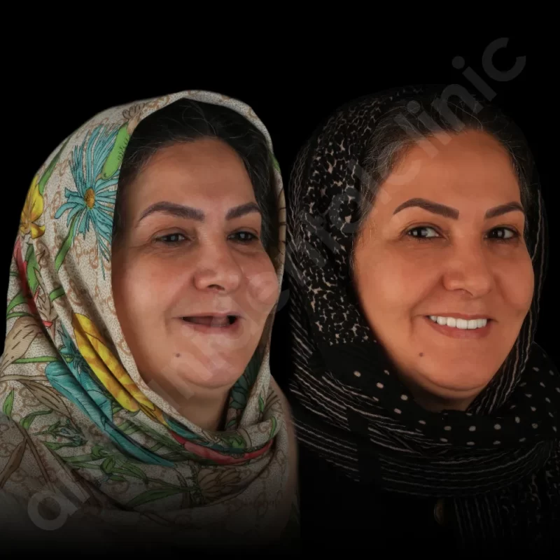آرمانی 35